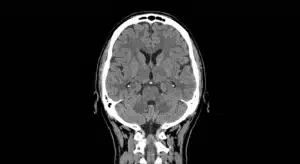 scanner